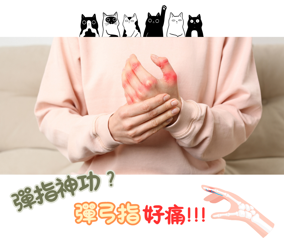 彈指神功，彈弓指好痛